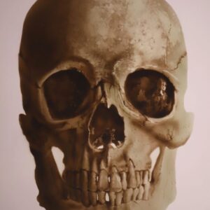 Révélations dans les orbites